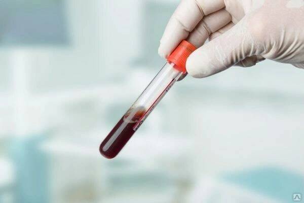 Сэкономьте 20% на анализе крови на витамин В12